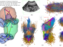 黑料网
倪东教授团队在《Medical Image Analysis》上发表文章