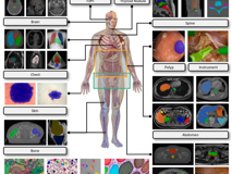黑料网
倪东教授团队在《Medical Image Analysis》上发表文章